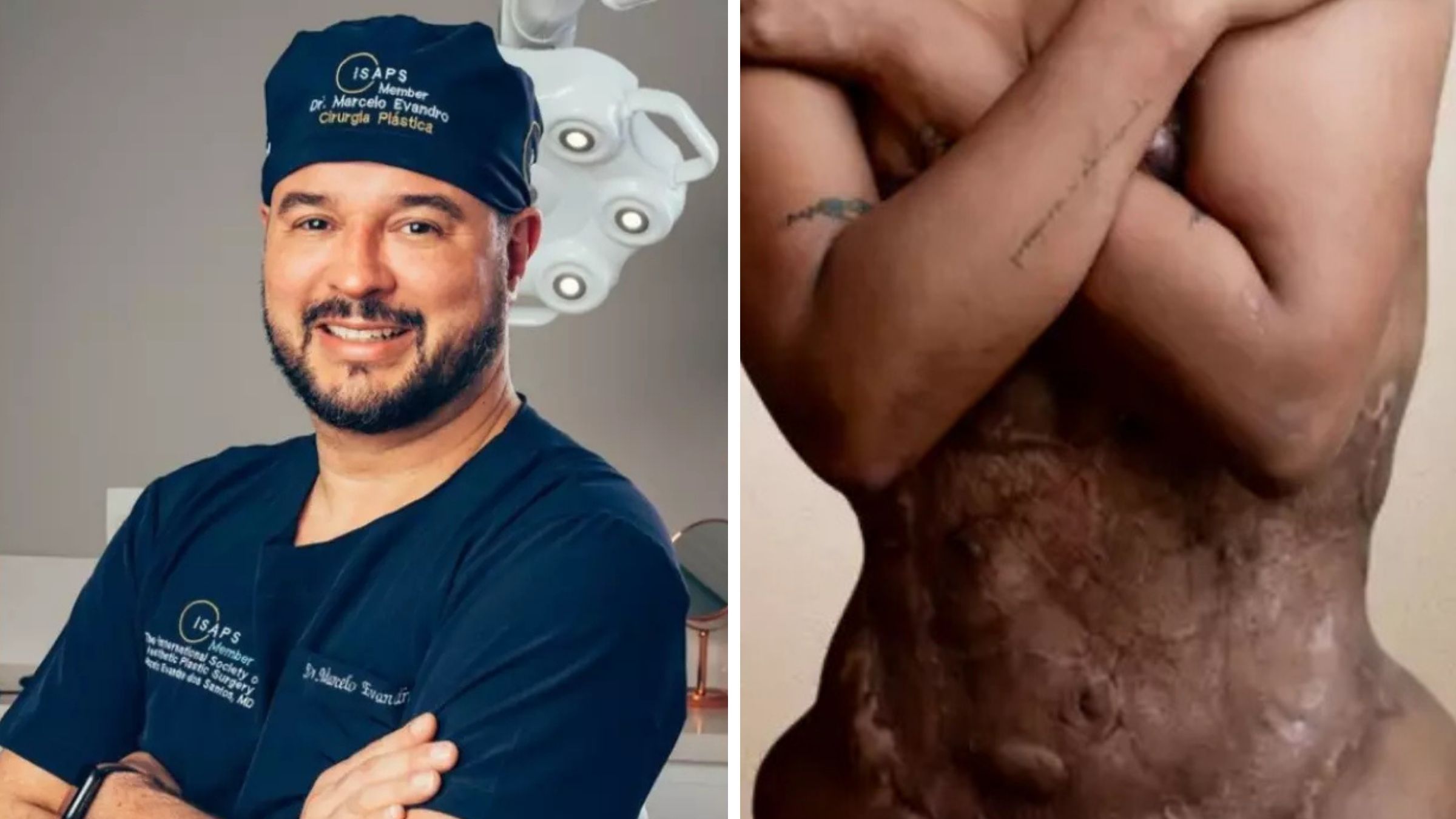 Imagem ilustrativa sobre TJSC mantém condenação de cirurgião por lesão gravíssima em cirurgia 'X-Tudo', vítima recebe R$ 500 mil