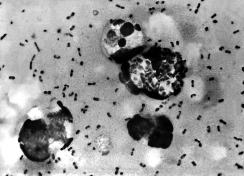 Imagem ilustrativa sobre Pesquisadora morre em laboratório siberiano; Rússia descarta risco de peste pneumônica